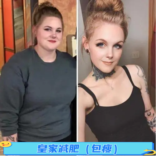 皇家减肥（包瘦）